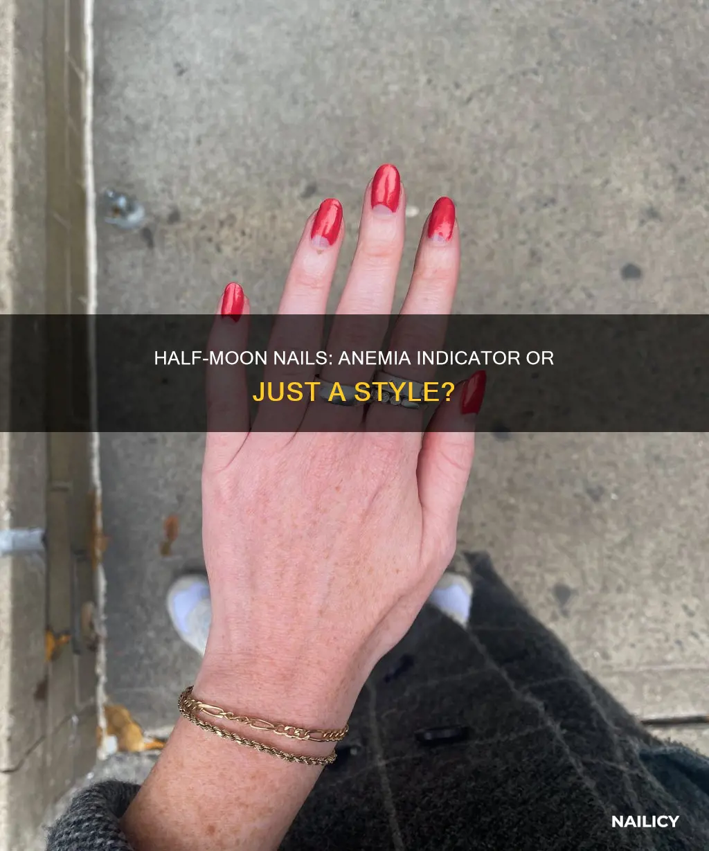 do half moon nails mean anemia