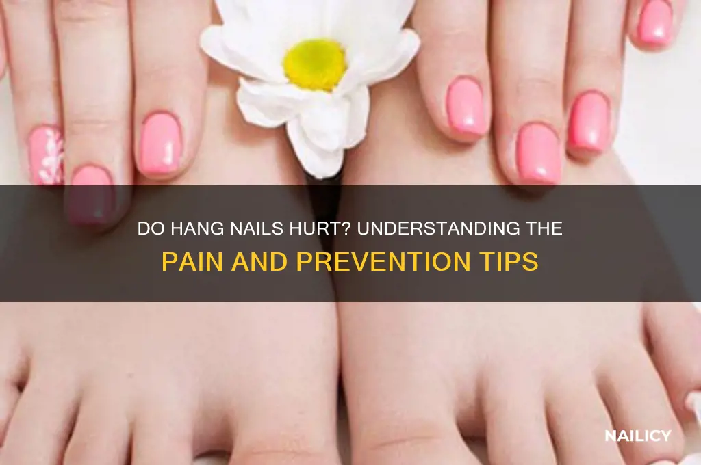 do hang nails hurt