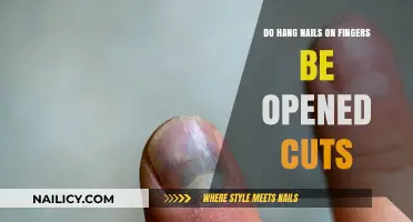 Hang Nails: To Cut or Not to Cut?
