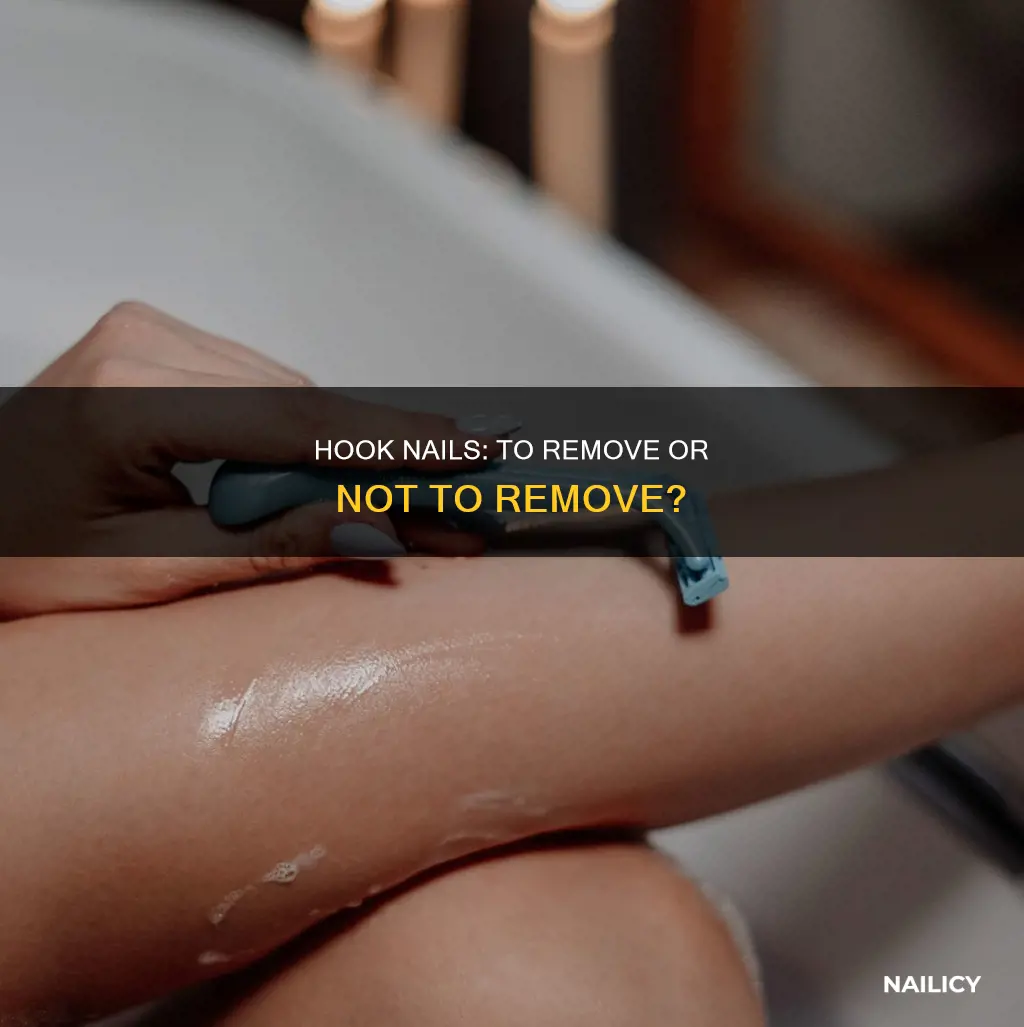 do hook nail need to be removed