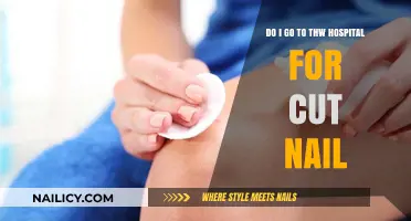 When to Seek Medical Help for a Nail Cut