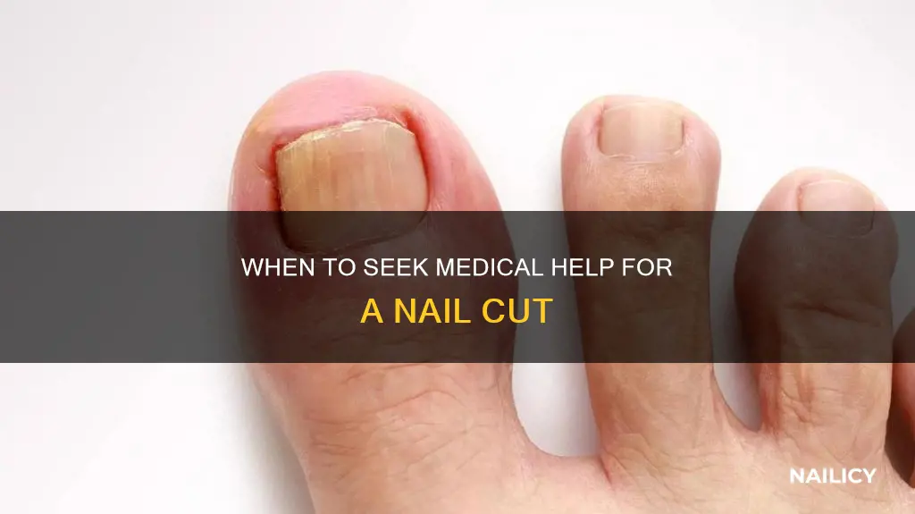 do i go to thw hospital for cut nail