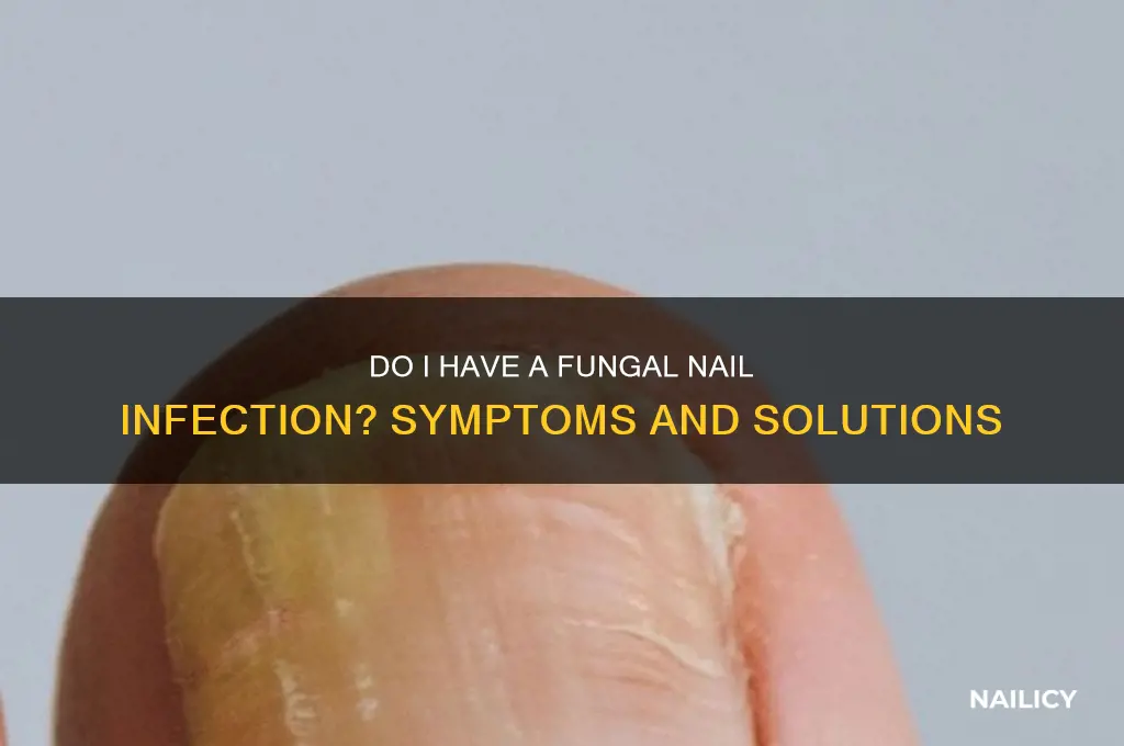 do i have a fungal nail infection