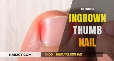 Ingrown Thumb Nail: Symptoms, Causes, and Treatment Options Explained