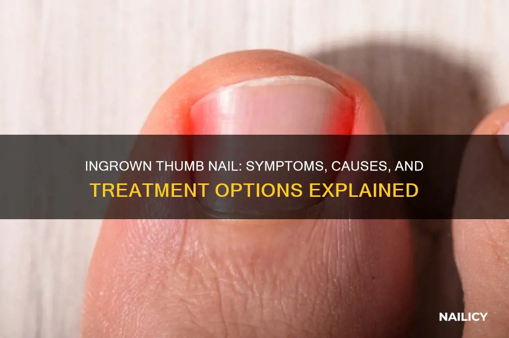 do i have a ingrown thumb nail
