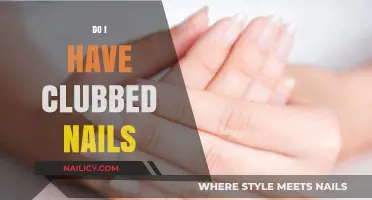 Clubbed Nails: Understanding Symptoms, Causes, and When to Seek Help