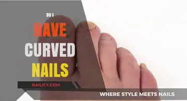 Curved Nails: Understanding Causes, Concerns, and When to Seek Help