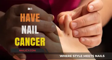 Do I Have Nail Cancer? Symptoms, Causes, and When to Seek Help