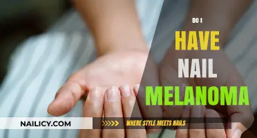 Do I Have Nail Melanoma? Symptoms, Risks, and When to See a Doctor