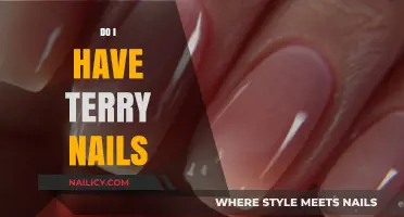 Do I Have Terry Nails? Identifying Symptoms and Seeking Answers