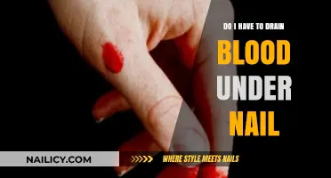 Should You Drain Blood Under a Nail? Quick Tips and Advice