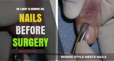 Gel Nails: Safe or Not Before Surgery?