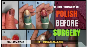 Surgery and Nail Polish: Is Removal Necessary?