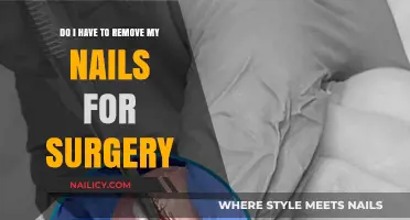 Surgery and Nails: What You Need to Know