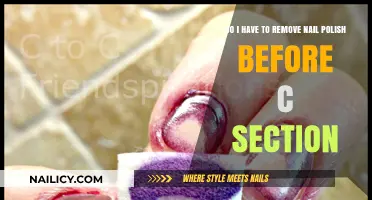 C-Section Prep: Nail Polish Removal Necessary?
