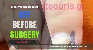 Surgery Prep: Should You Remove Nail Polish Beforehand?