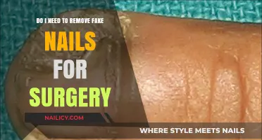 Preparing for Surgery: Fake Nails, a Concern?