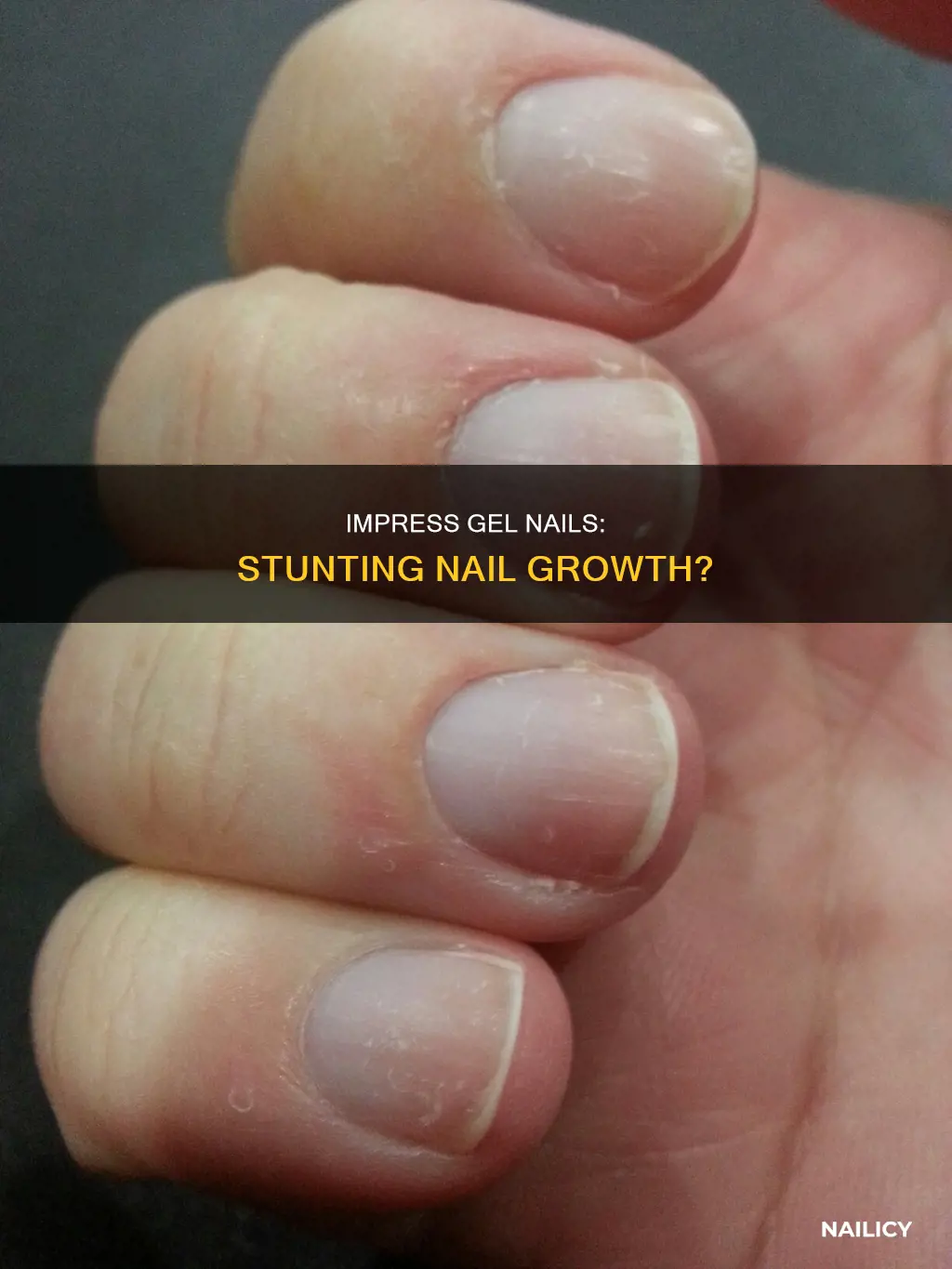 do impress gel nails shorten nail growth