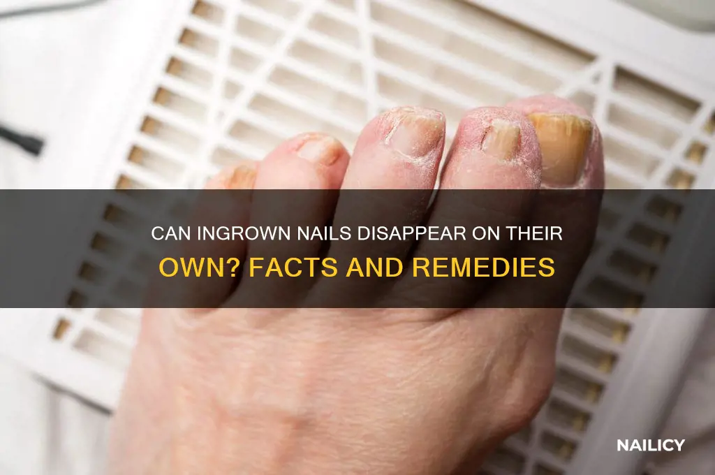 do in grown nails ever go away