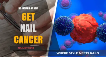 Exploring Nail Cancer Risks Among Asian Indians: Facts and Prevention