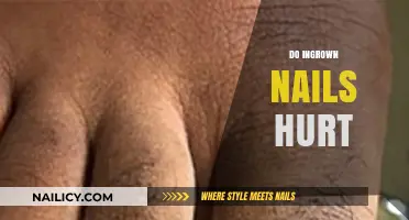 Do Ingrown Nails Hurt? Understanding the Pain and Solutions
