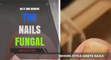 Eradicate Nail Fungus with This Simple Solution