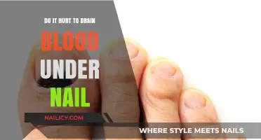 Does Draining Blood Under a Nail Cause Pain? What to Expect