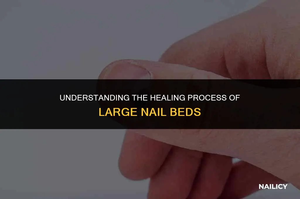 do large nail beds heal and get smaller