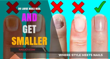 Understanding Nail Health: Do Large Nails Heal and Shrink Over Time?