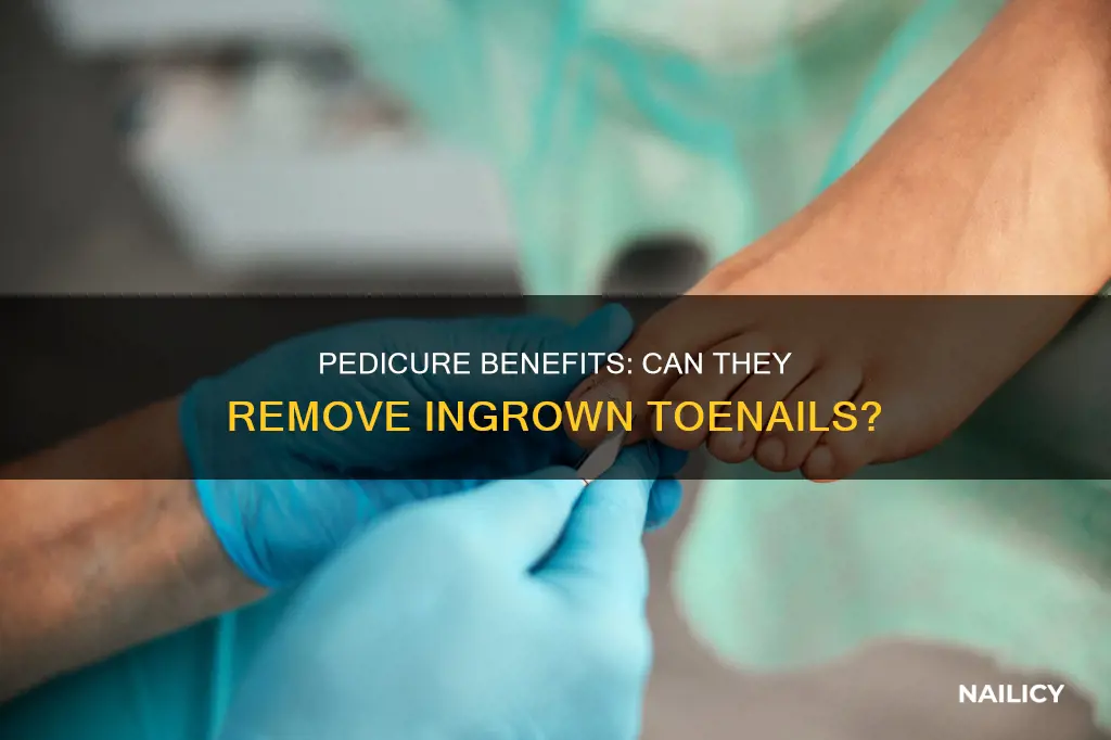 do mani pedis remove in grown toe nails