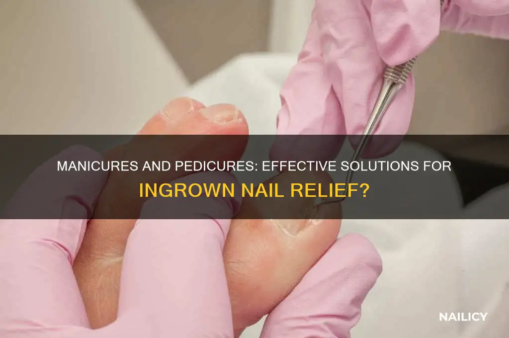 do manicures and pedicures help with ingrown nail