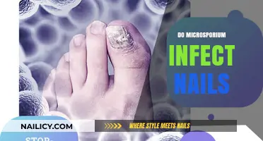 Microsporium and Nail Infections: Causes, Symptoms, and Treatment Options