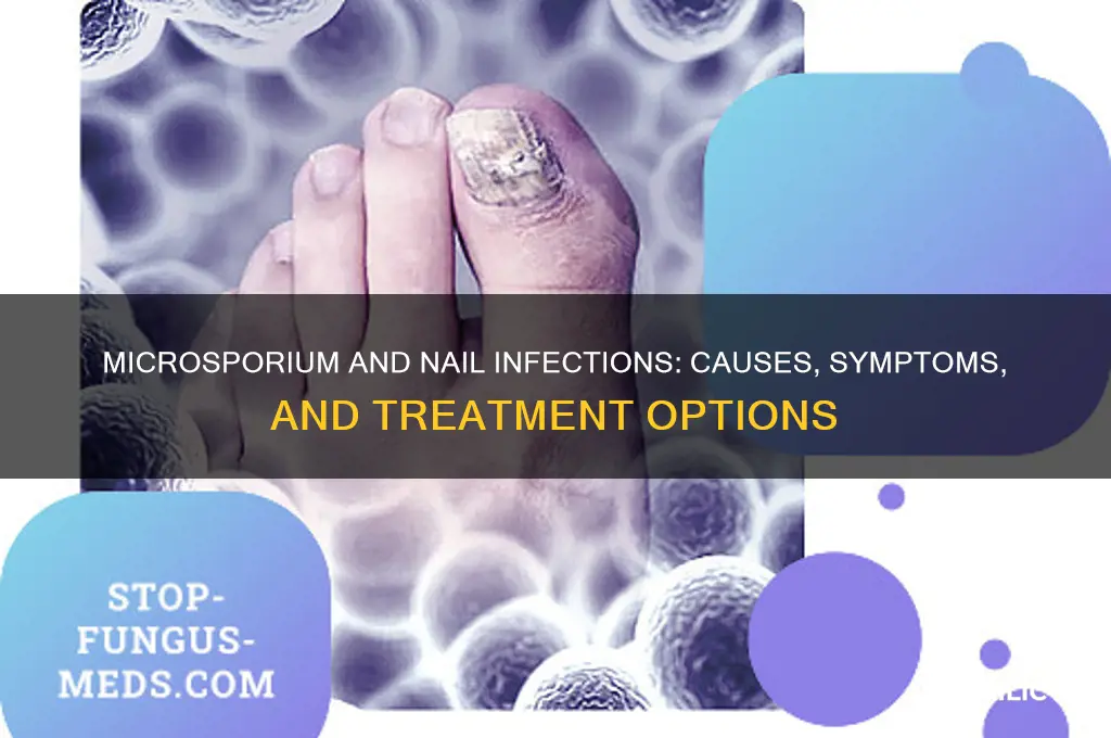 do microsporium infect nails