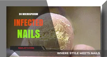 Microsporum Nail Infections: Causes, Symptoms, and Effective Treatment Options