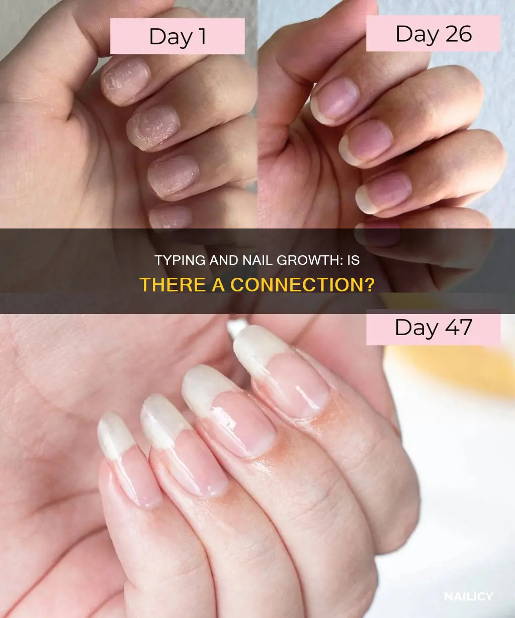 do my nails grow fast beacuse i type