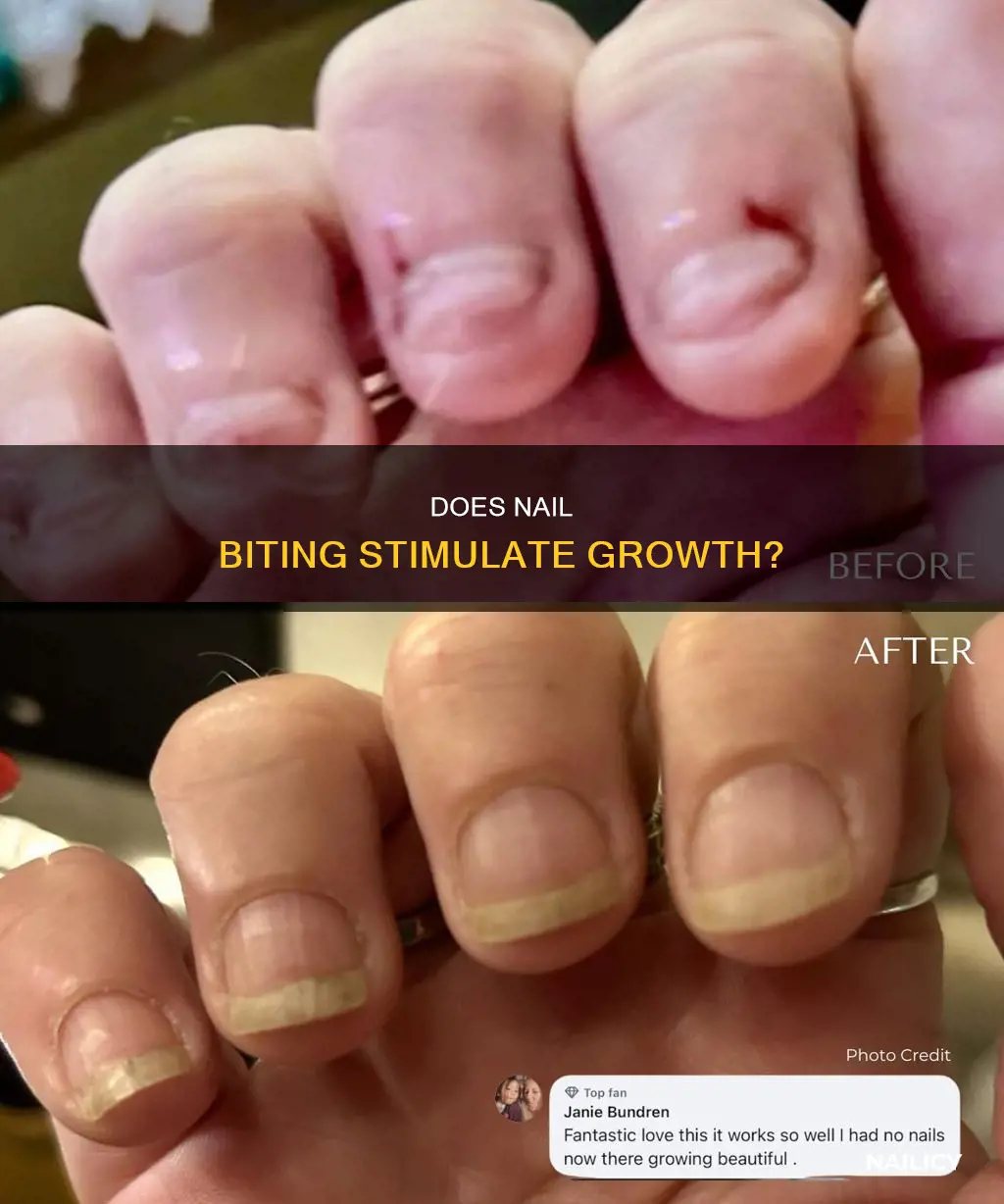 do my nails grow faster becausue i bite them