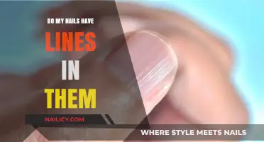 Understanding Nail Lines: Causes, Concerns, and When to Seek Advice
