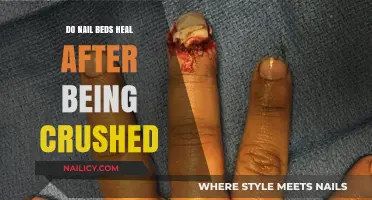 Can Crushed Nail Beds Heal? Recovery Process and What to Expect
