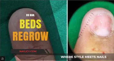 Can Damaged Nail Beds Regrow? Understanding Healing and Recovery Process