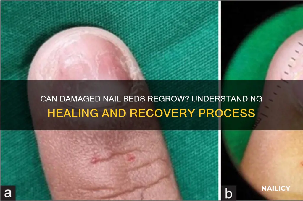 do nail beds regrow