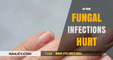 Do Nail Fungal Infections Cause Pain? Understanding Symptoms and Discomfort