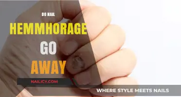 Do Nail Hemorrhages Go Away? Understanding Causes, Treatment, and Healing