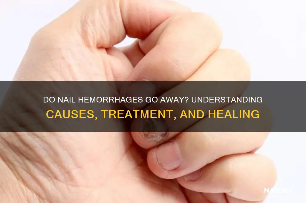 do nail hemmhorage go away