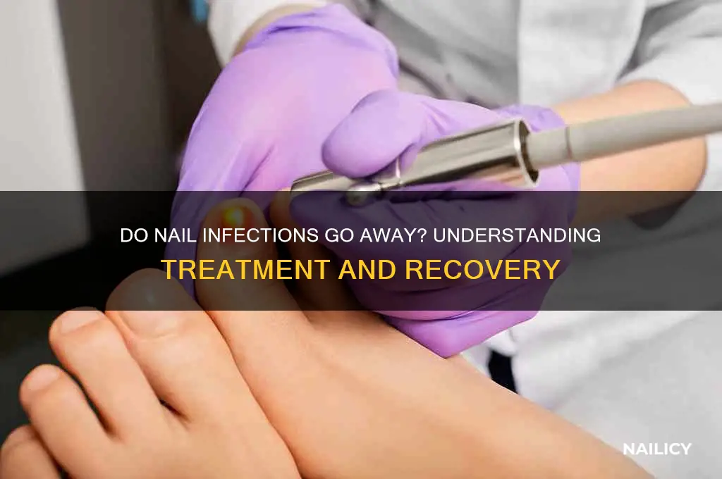 do nail infections go away