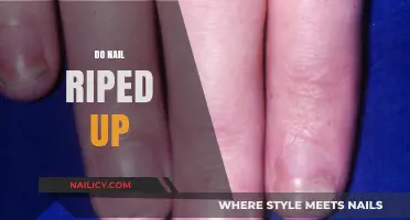Understanding Nail Ripping: Causes, Prevention, and Effective Treatment Options