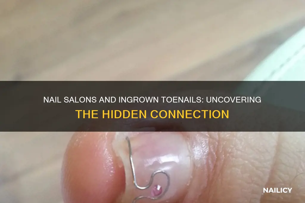 do nail salons cause ingrown toenails