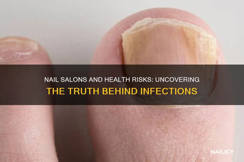 do nail salons cause mis