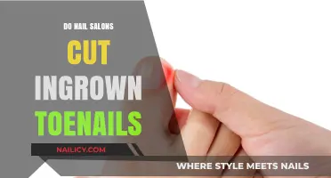 Toenail Troubles? Nail Salons Can Help