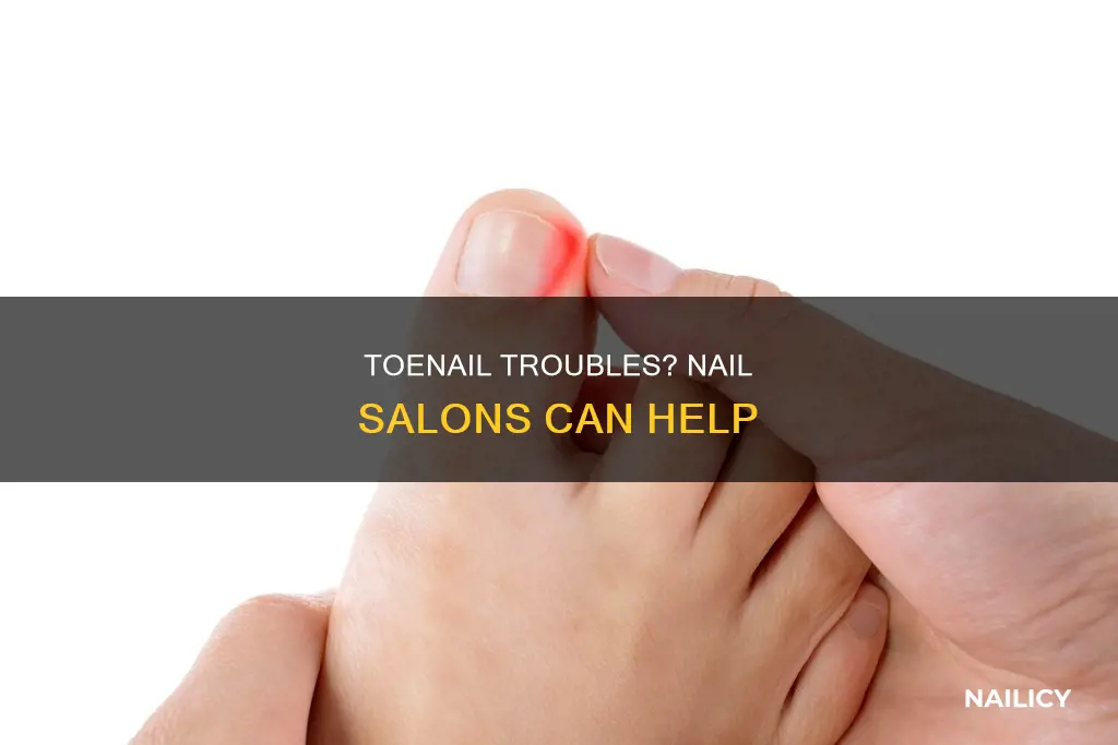 do nail salons cut ingrown toenails