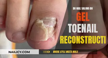 Gel Toenail Reconstruction: A Service at Nail Salons?